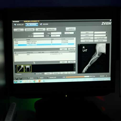 Radiografía de una extremidad en el monitor de diagnóstico